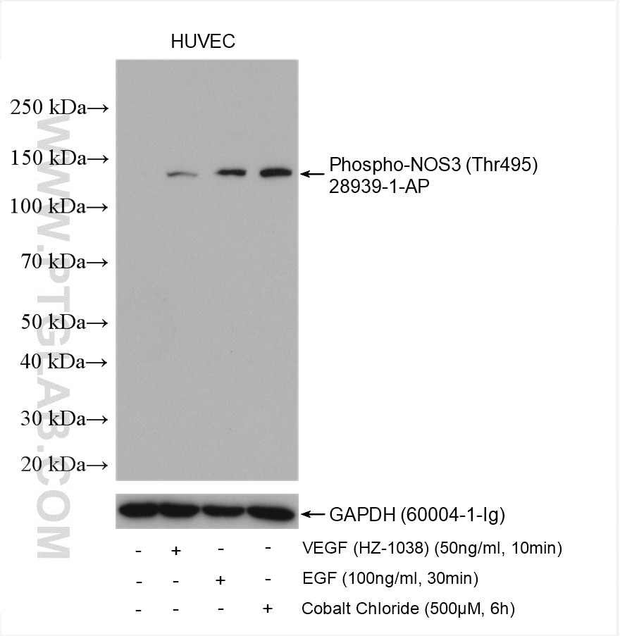 Western Blot (WB) analysis of various lysates using Phospho-eNOS (Thr495) Polyclonal antibody (28939-1-AP)