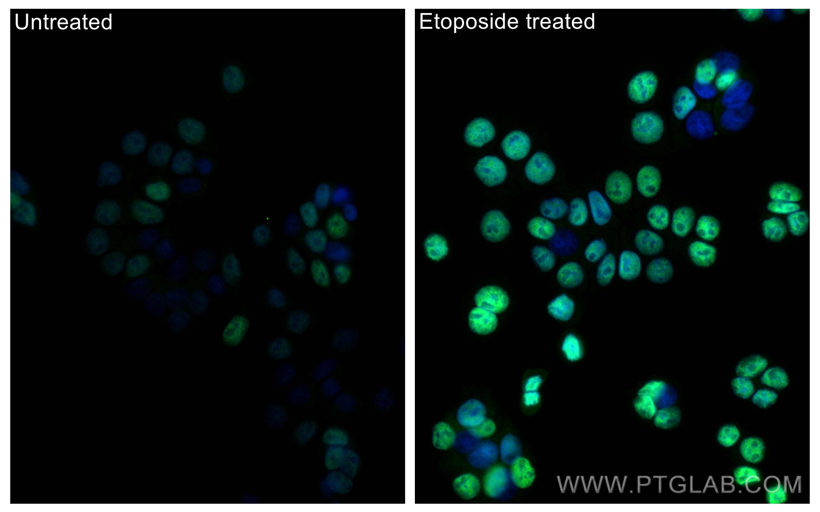 Immunofluorescence (IF) / fluorescent staining of HT-29 cells using Phospho-P53 (Ser15) Polyclonal antibody (28961-1-AP)