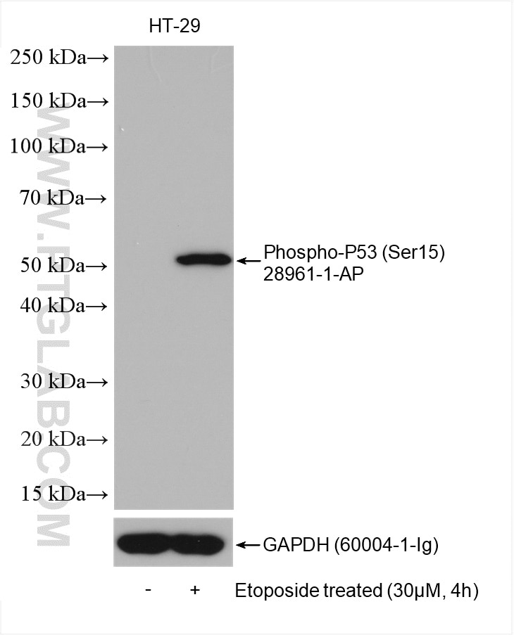 Western Blot (WB) analysis of various lysates using Phospho-P53 (Ser15) Polyclonal antibody (28961-1-AP)