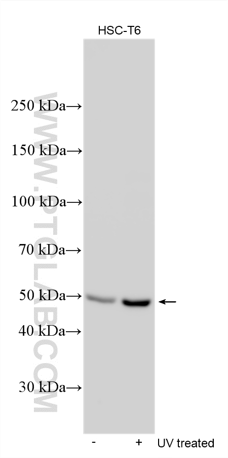 Western Blot (WB) analysis of various lysates using Phospho-P53 (Ser15) Polyclonal antibody (28961-1-AP)