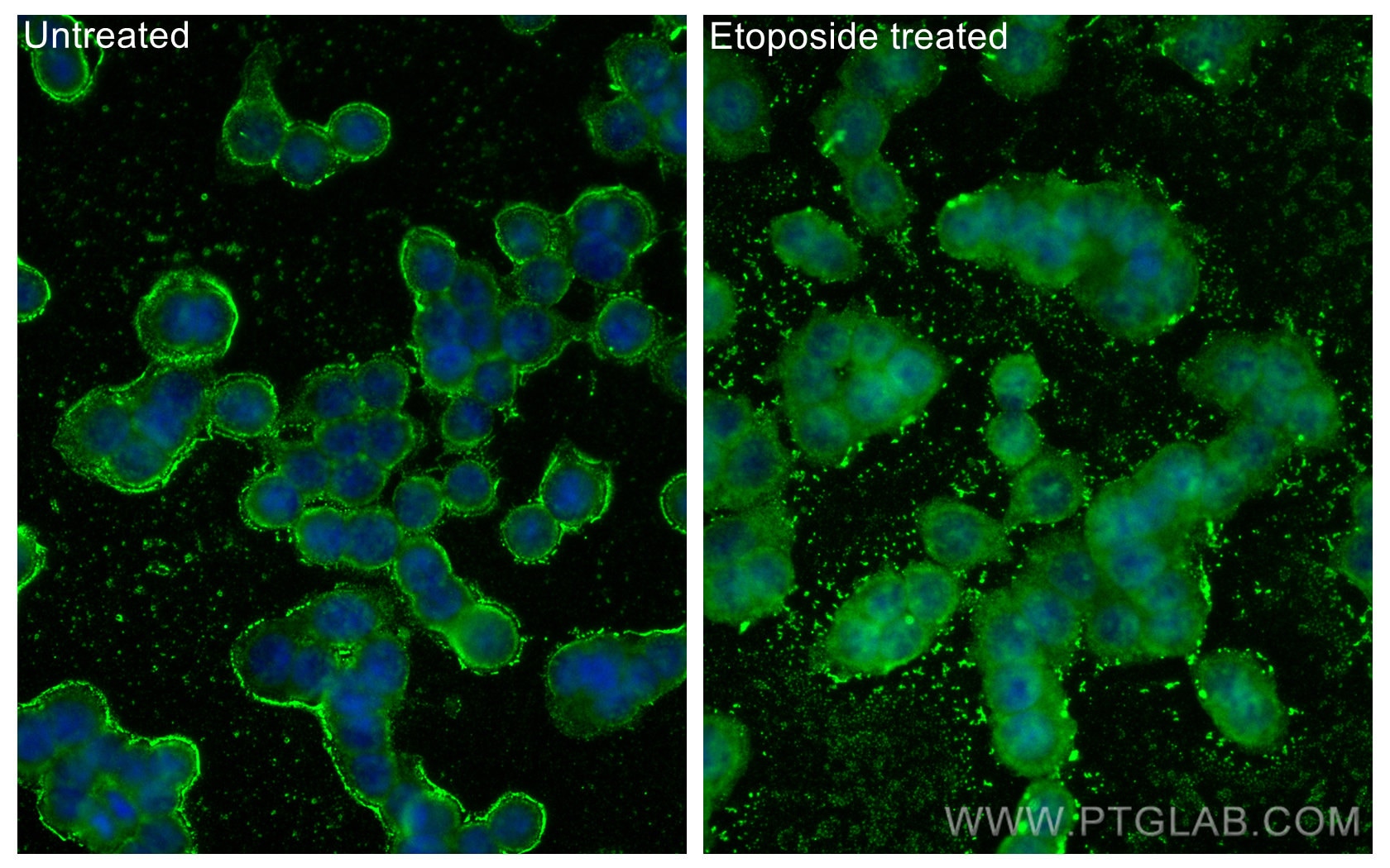 Immunofluorescence (IF) / fluorescent staining of HT-29 cells using Phospho-P53 (Ser15) Monoclonal antibody (67826-1-Ig)