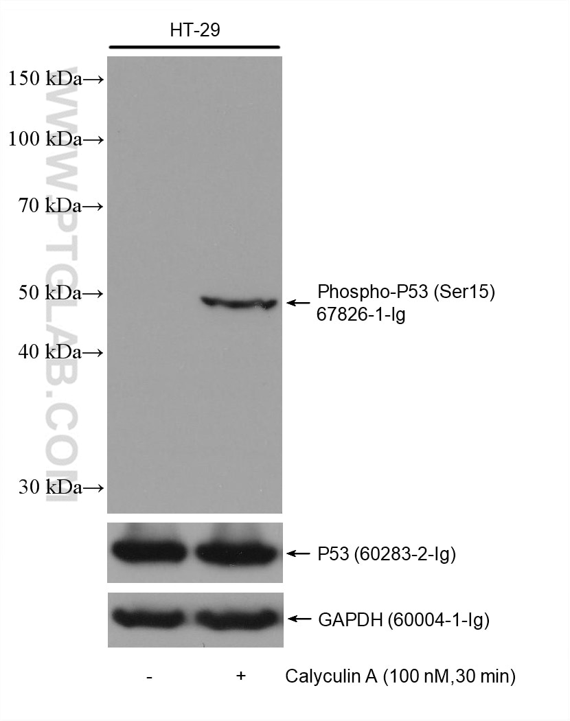 Western Blot (WB) analysis of various lysates using Phospho-P53 (Ser15) Monoclonal antibody (67826-1-Ig)