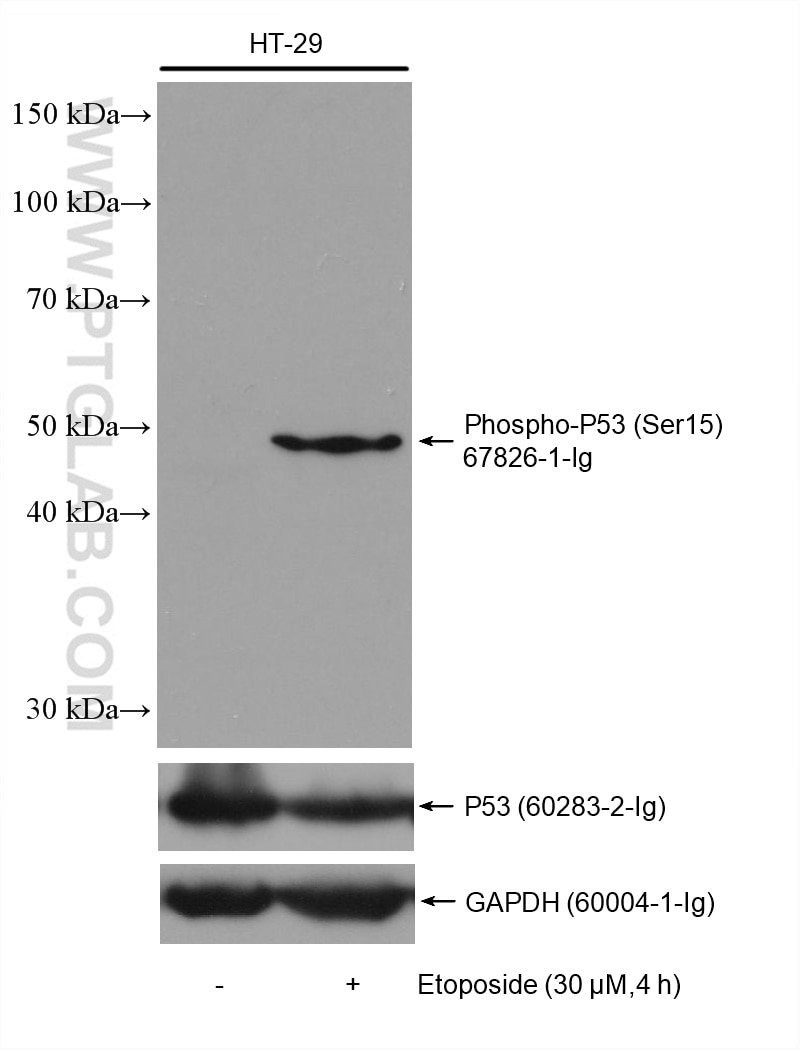 Western Blot (WB) analysis of various lysates using Phospho-P53 (Ser15) Monoclonal antibody (67826-1-Ig)