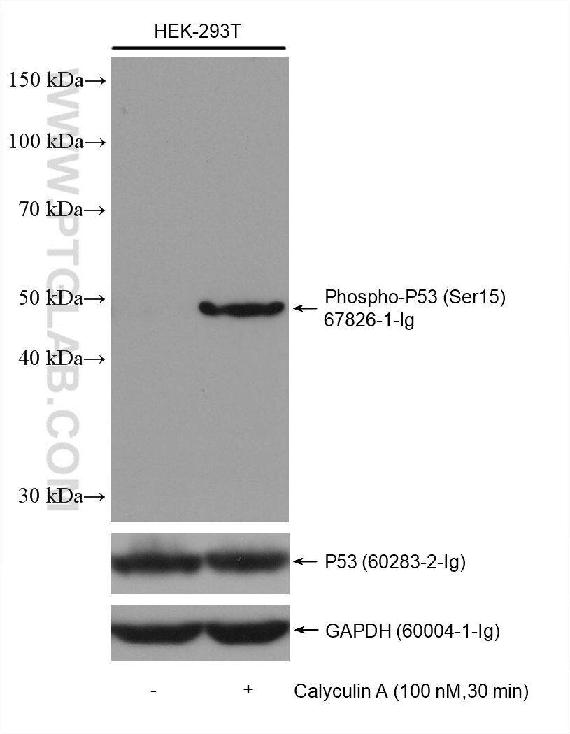 Western Blot (WB) analysis of various lysates using Phospho-P53 (Ser15) Monoclonal antibody (67826-1-Ig)