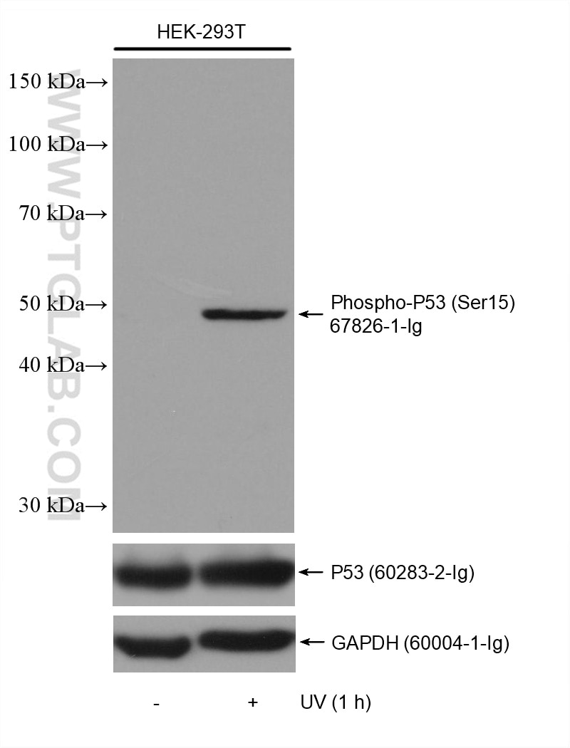 Western Blot (WB) analysis of various lysates using Phospho-P53 (Ser15) Monoclonal antibody (67826-1-Ig)