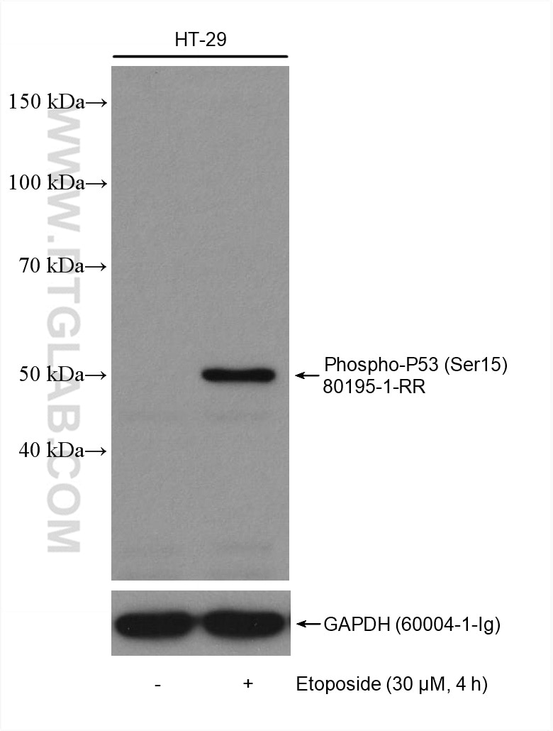 Western Blot (WB) analysis of various lysates using Phospho-P53 (Ser15) Recombinant antibody (80195-1-RR)