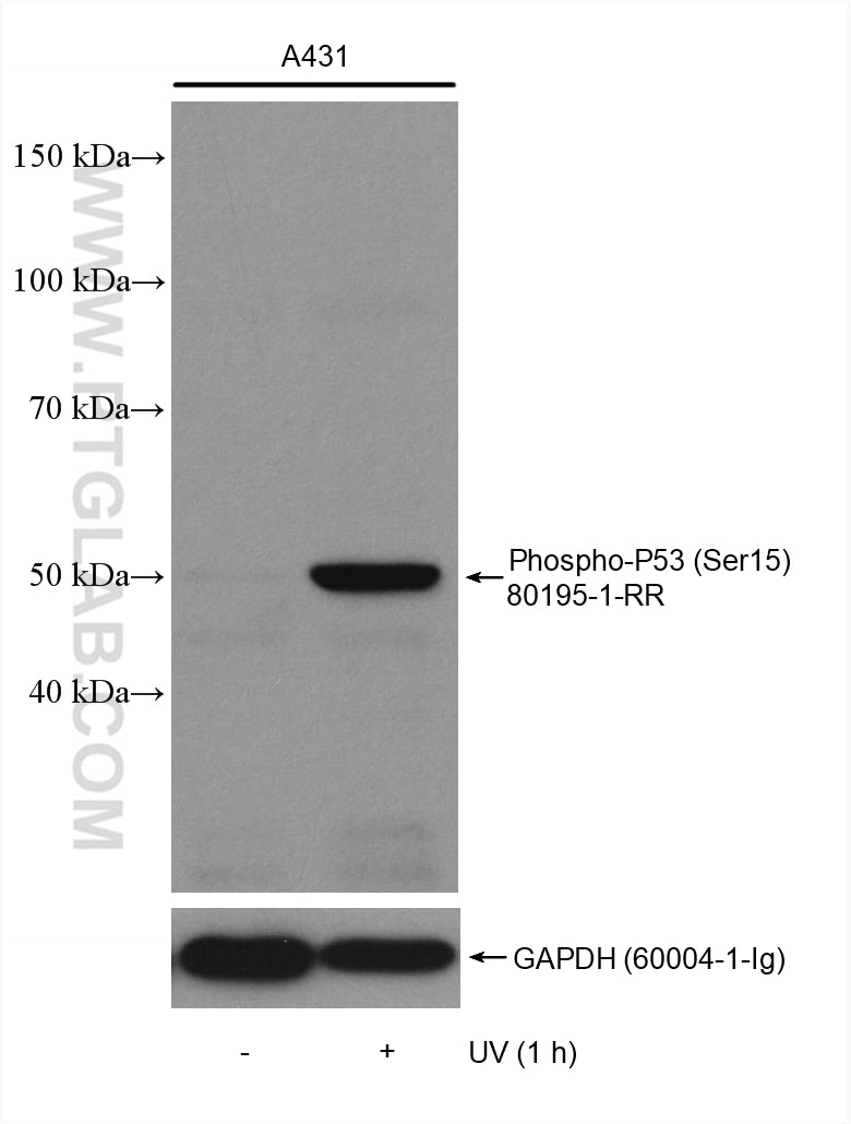 Western Blot (WB) analysis of various lysates using Phospho-P53 (Ser15) Recombinant antibody (80195-1-RR)