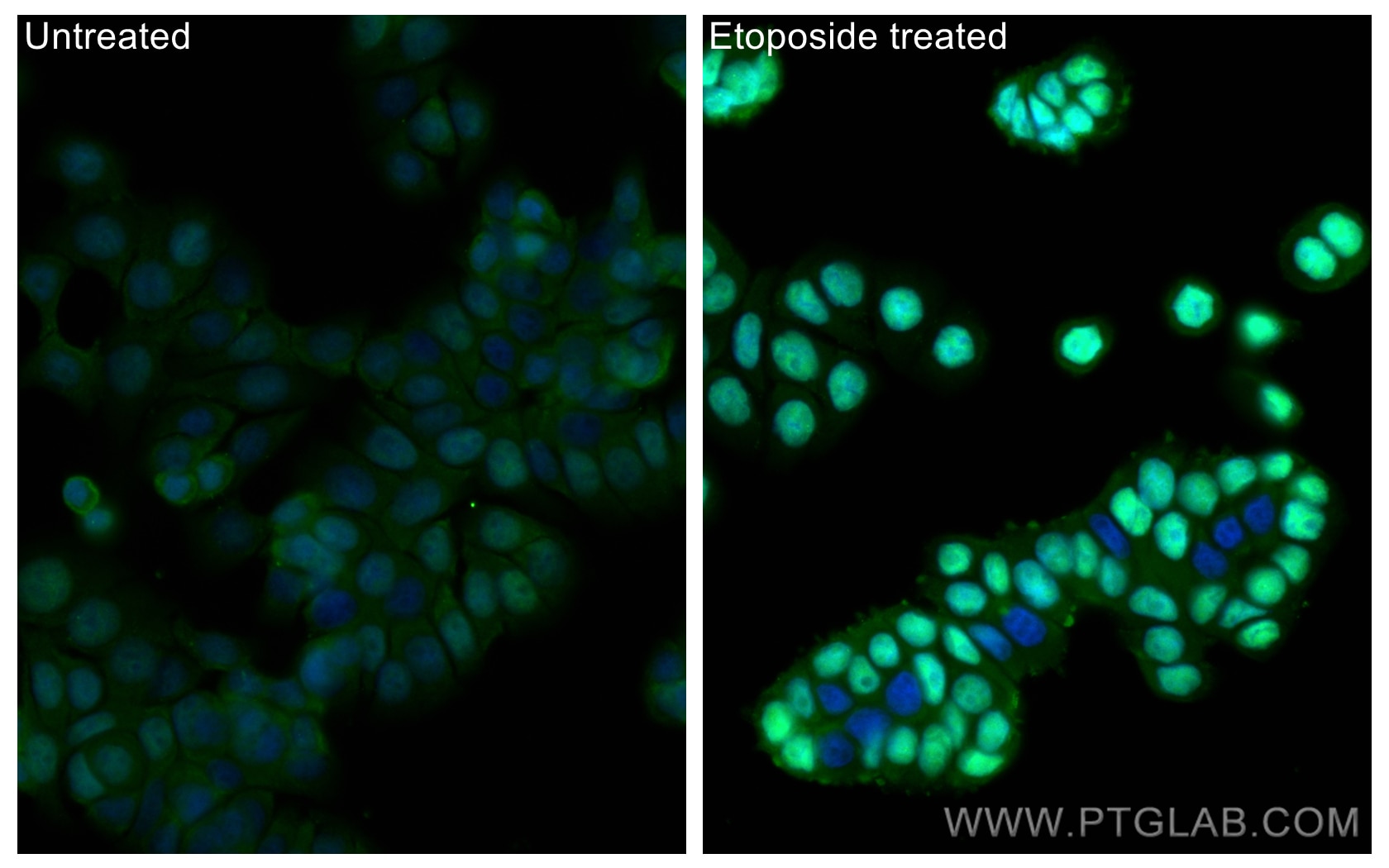 Phospho-P53 (Ser15)