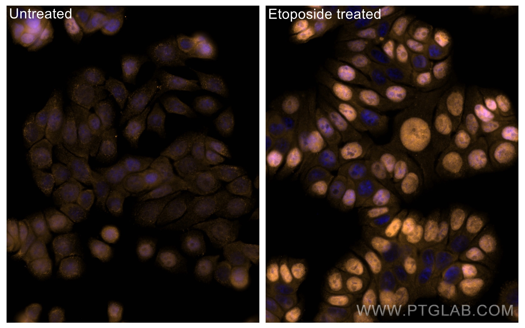Immunofluorescence (IF) / fluorescent staining of HT-29 cells using CoraLite®555-conjugated Phospho-P53 (Ser15) Recomb (CL555-80195)