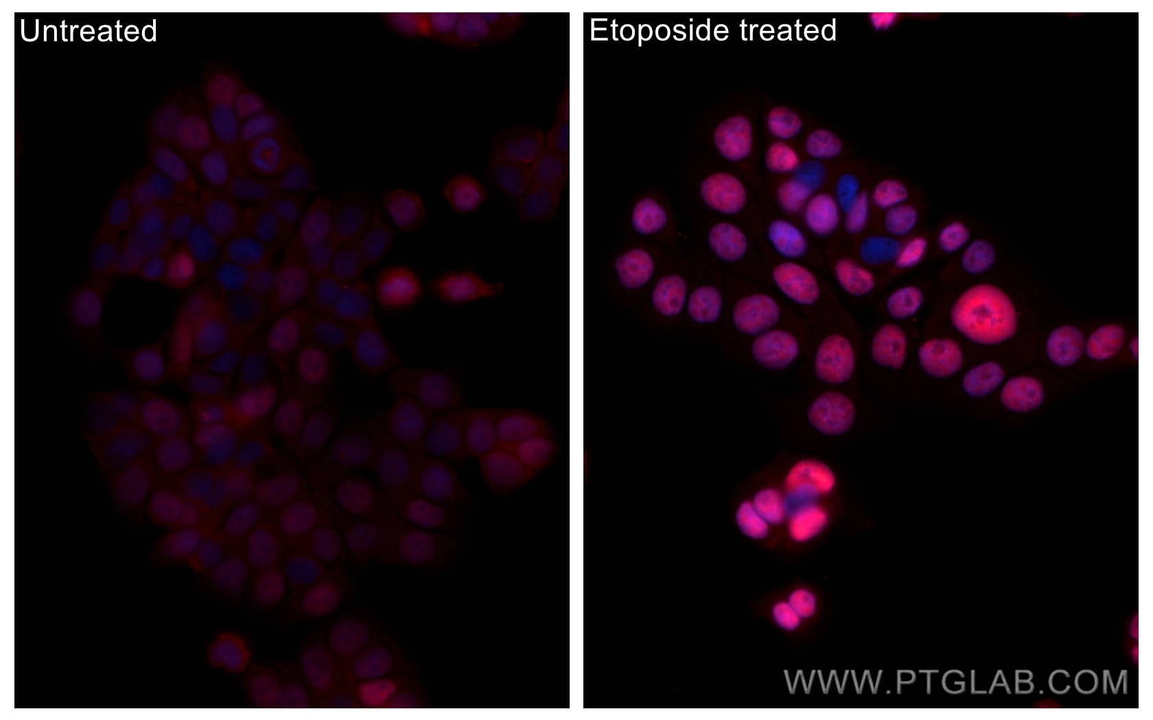 Immunofluorescence (IF) / fluorescent staining of HT-29 cells using CoraLite®594-conjugated Phospho-P53 (Ser15) Recomb (CL594-80195)