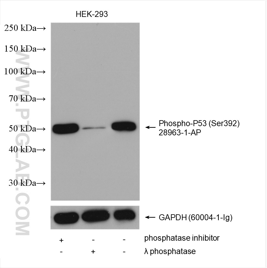 Western Blot (WB) analysis of various lysates using Phospho-P53 (Ser392) Polyclonal antibody (28963-1-AP)