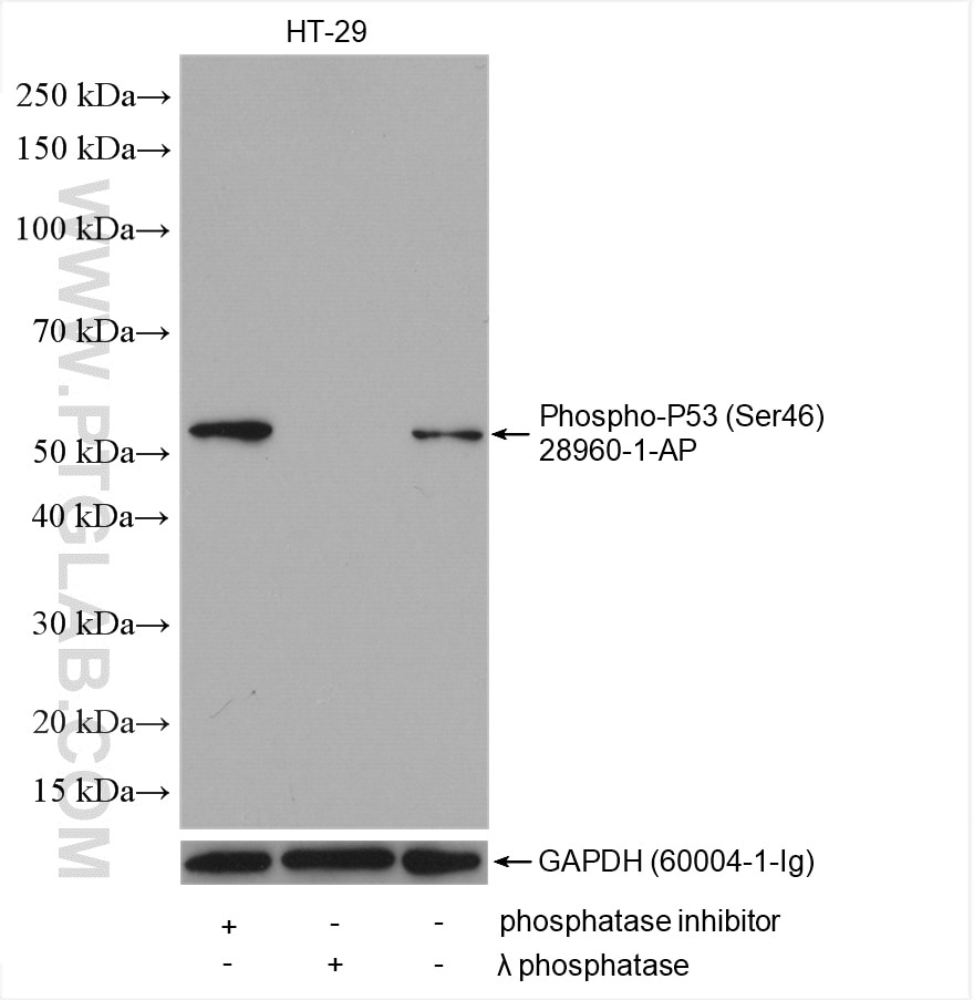 Western Blot (WB) analysis of various lysates using Phospho-P53 (Ser46) Polyclonal antibody (28960-1-AP)