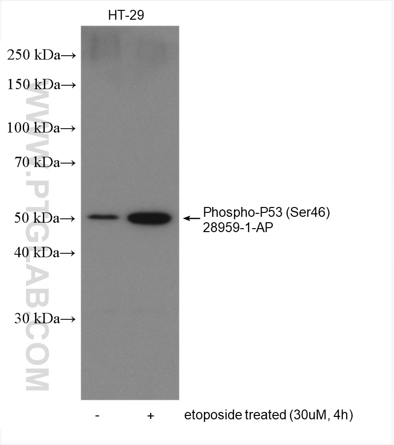 Western Blot (WB) analysis of various lysates using Phospho-P53 (Ser46) Polyclonal antibody (28960-1-AP)