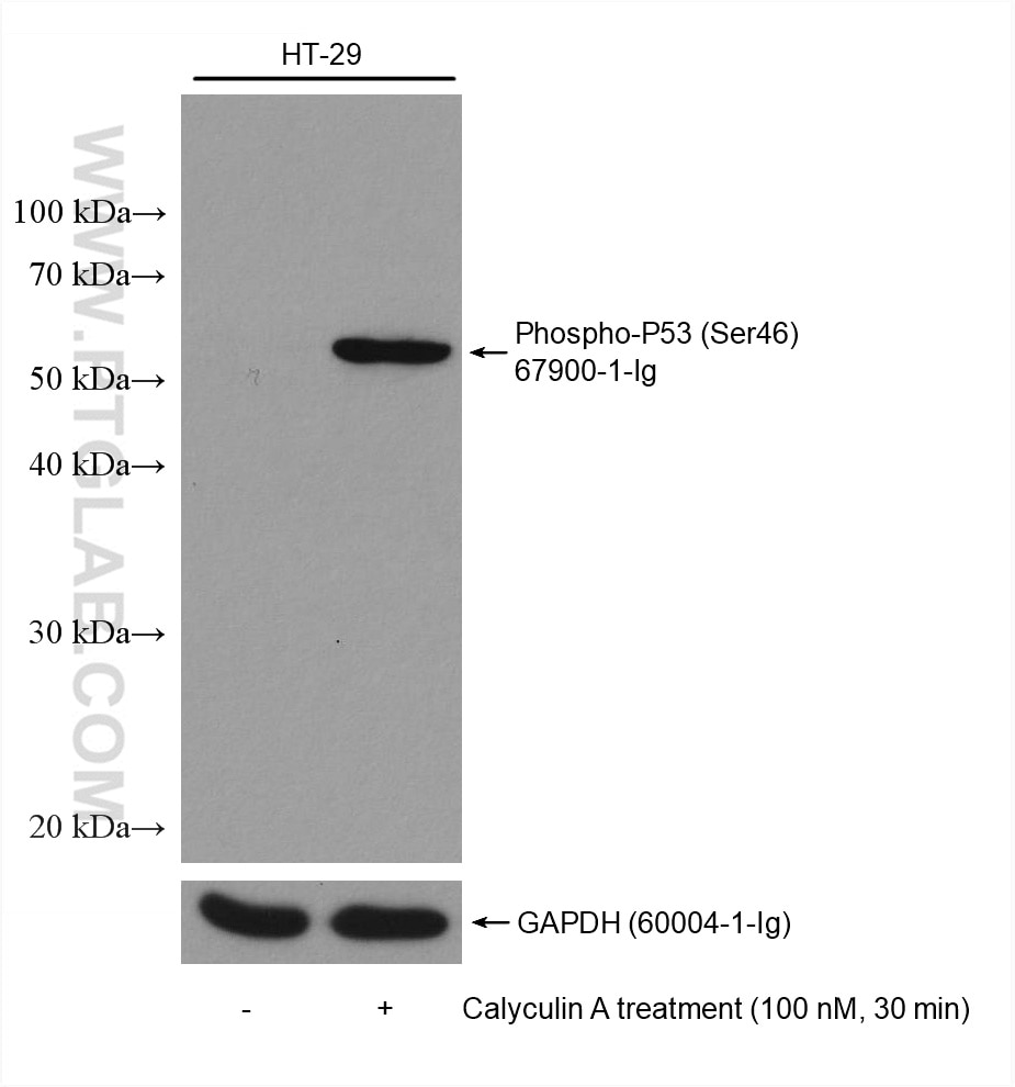 Western Blot (WB) analysis of various lysates using Phospho-P53 (Ser46) Monoclonal antibody (67900-1-Ig)