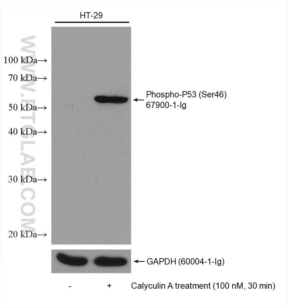 Phospho-P53 (Ser46)