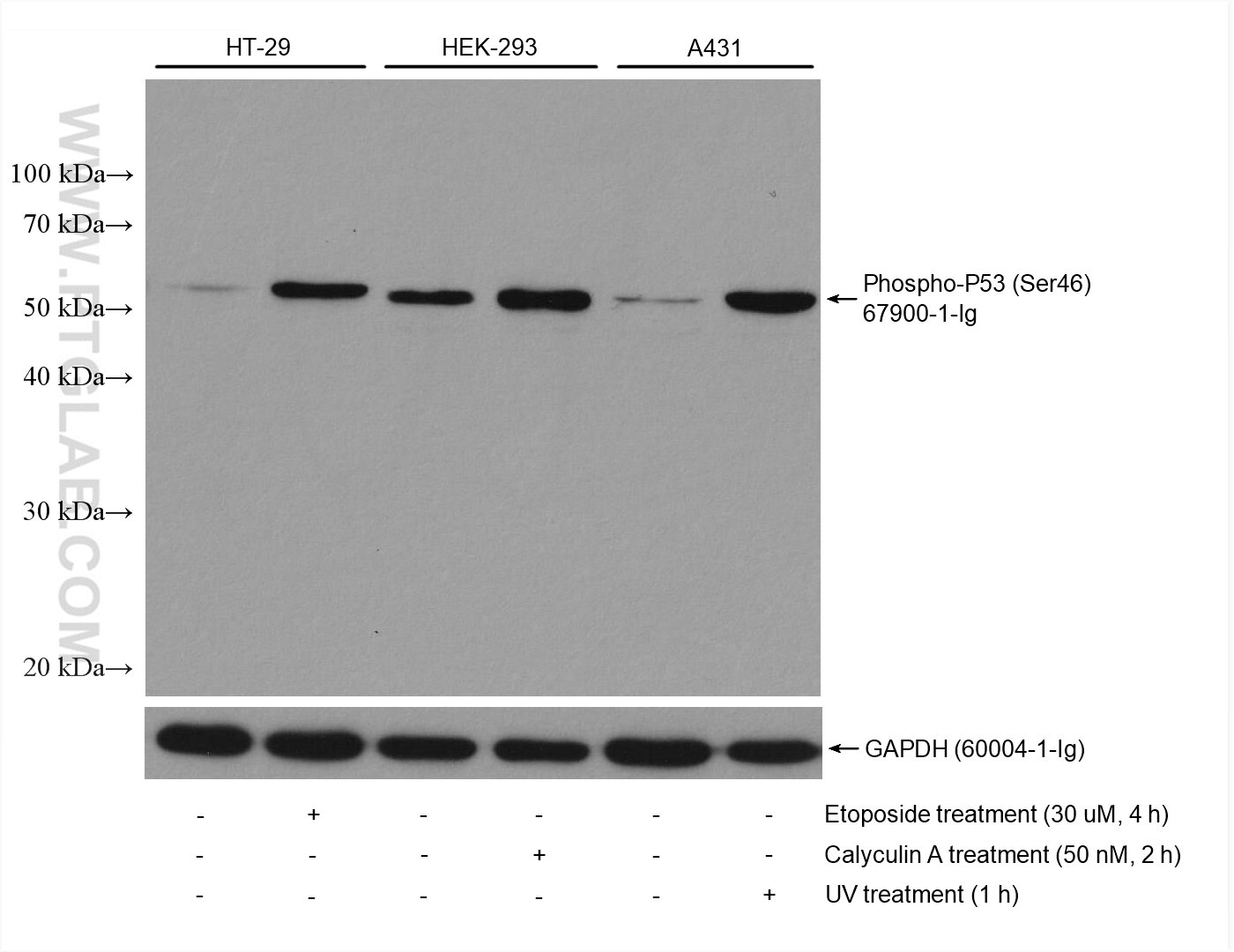 Western Blot (WB) analysis of various lysates using Phospho-P53 (Ser46) Monoclonal antibody (67900-1-Ig)