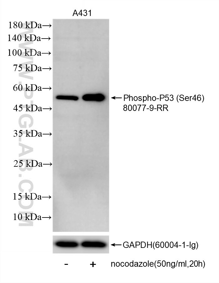 Western Blot (WB) analysis of A431 cells using Phospho-P53 (Ser46) Recombinant monoclonal antibod (80077-9-RR)
