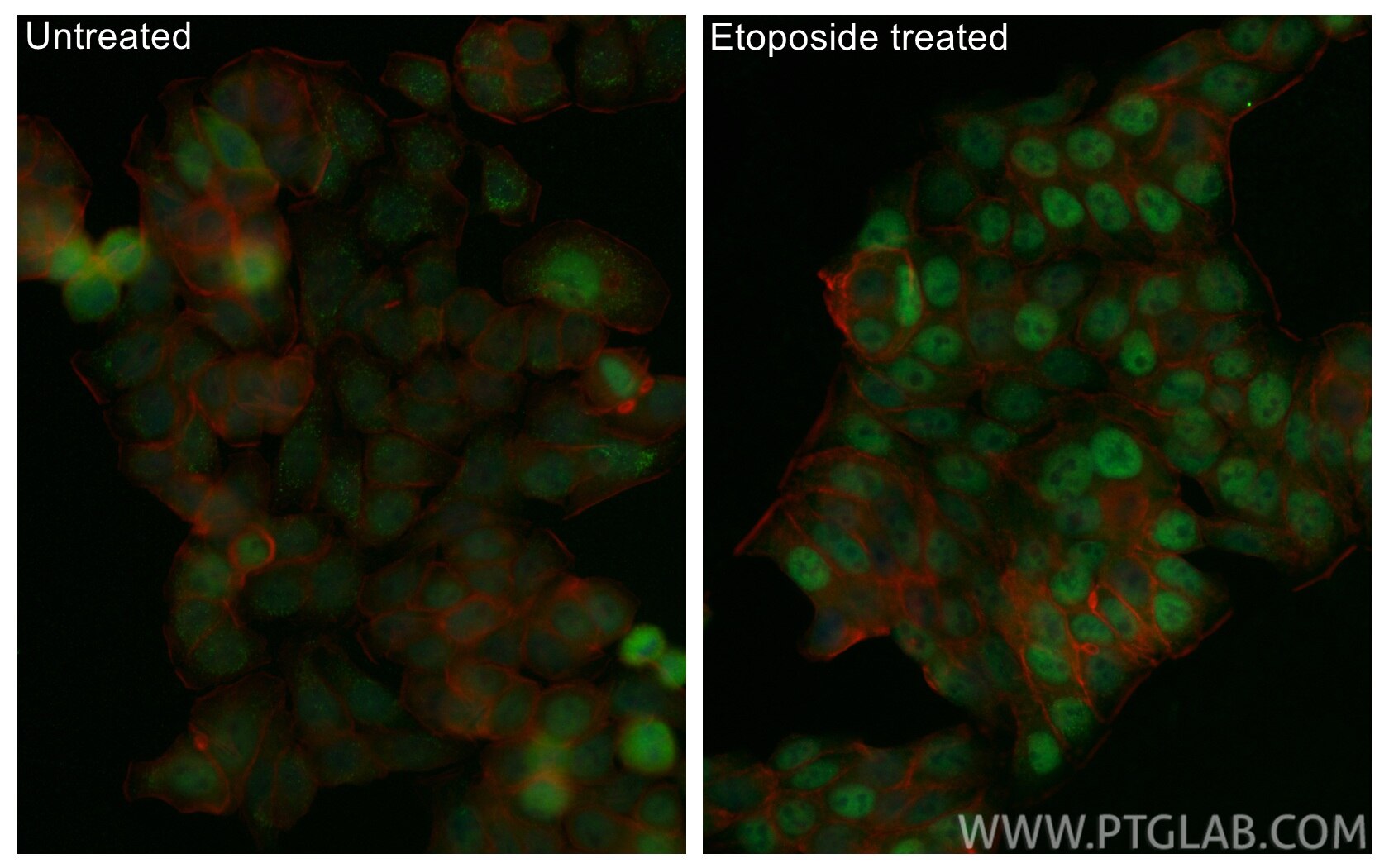 IF Staining of HT-29 using CL488-80077-9 Immunofluorescence (IF) / fluorescent staining of HT-29 cells using CoraLite® Plus 488-conjugated Phospho-P53 (Ser46) (CL488-80077-9)