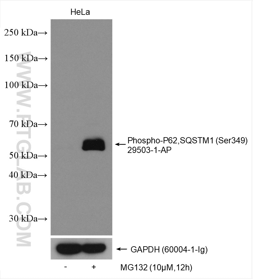 Western Blot (WB) analysis of various lysates using Phospho-P62,SQSTM1 (Ser349) Polyclonal antibody (29503-1-AP)