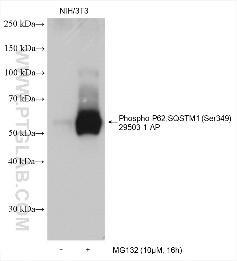 Phospho-P62,SQSTM1 (Ser349)