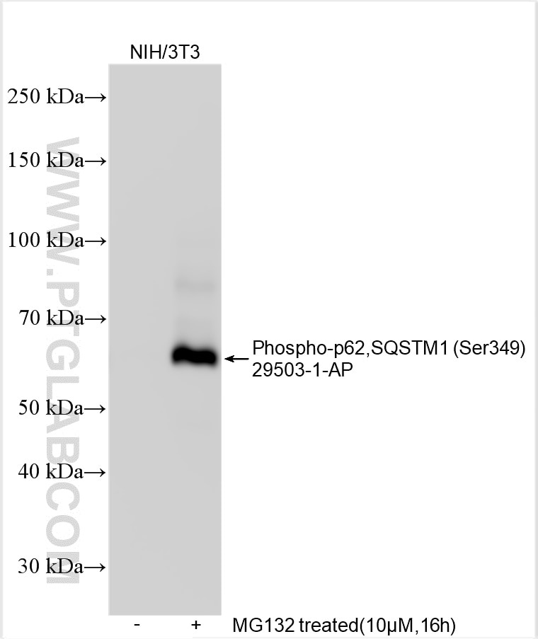 Western Blot (WB) analysis of various lysates using Phospho-P62,SQSTM1 (Ser349) Polyclonal antibody (29503-1-AP)