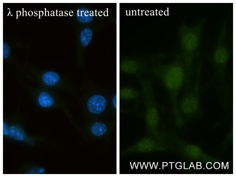 IF Staining of NIH/3T3 using 80294-2-RR Immunofluorescence (IF) / fluorescent staining of NIH/3T3 cells using Phospho-P62/SQSTM1 (Ser349) Recombinant monoclonal (80294-2-RR)