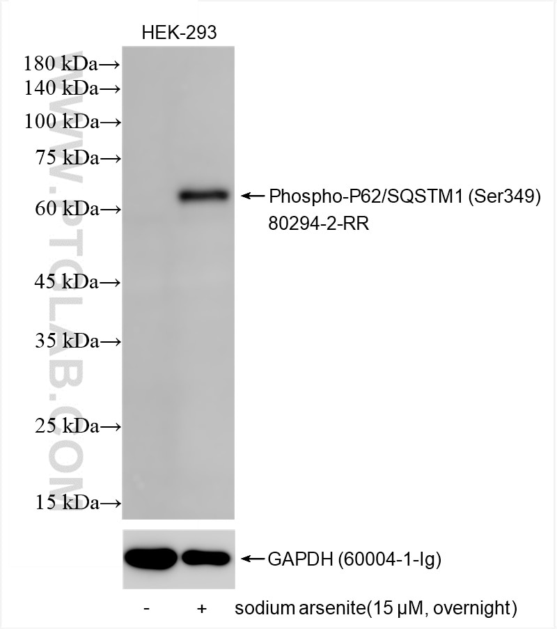 Western Blot (WB) analysis of HEK-293 cells using Phospho-P62/SQSTM1 (Ser349) Recombinant antibody (80294-2-RR)