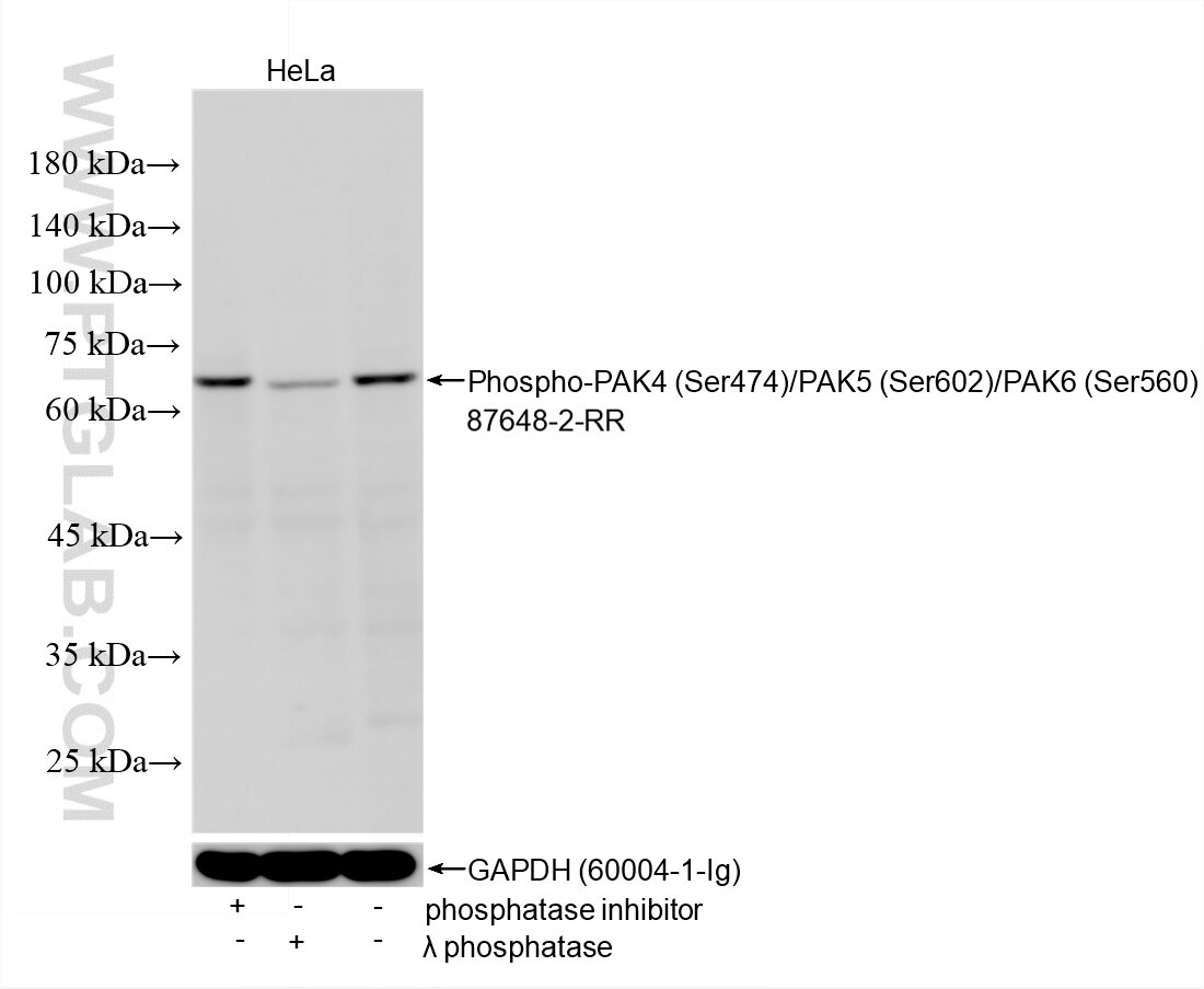 WB analysis using 87648-2-RR (same clone as 87648-2-PBS) Western Blot (WB) analysis of various lysates using Phospho-PAK4 (Ser474)/PAK5 (Ser602)/PAK6 (Ser560) (87648-2-RR)