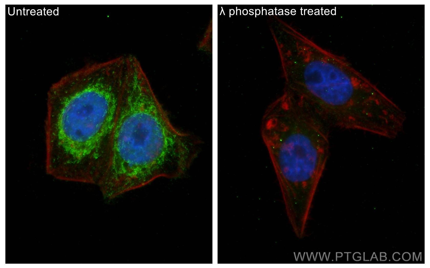 Immunofluorescence (IF) / fluorescent staining of HepG2 cells using Phospho-PDH E1 Alpha (Ser232) Polyclonal antibody (29582-1-AP)