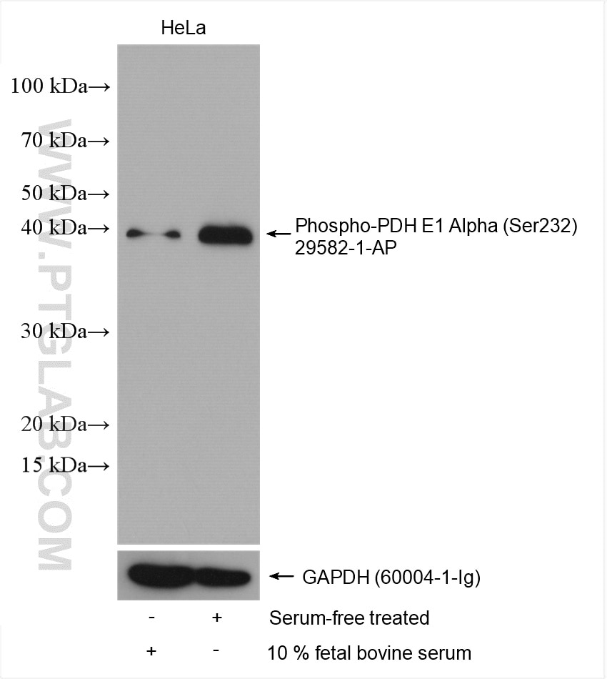 Western Blot (WB) analysis of various lysates using Phospho-PDH E1 Alpha (Ser232) Polyclonal antibody (29582-1-AP)