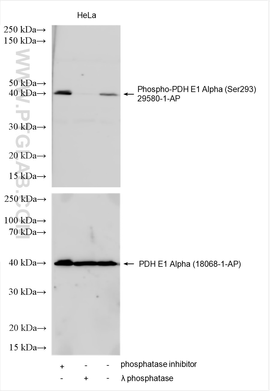 Western Blot (WB) analysis of various lysates using Phospho-PDH E1 Alpha (Ser293) Polyclonal antibody (29580-1-AP)