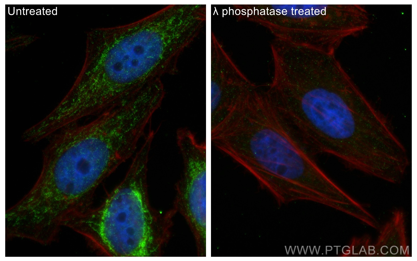 Immunofluorescence (IF) / fluorescent staining of HepG2 cells using Phospho-PDH E1 Alpha (Ser300) Polyclonal antibody (29583-1-AP)