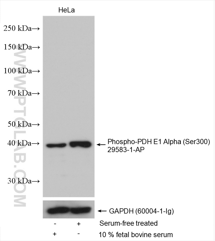 Western Blot (WB) analysis of various lysates using Phospho-PDH E1 Alpha (Ser300) Polyclonal antibody (29583-1-AP)