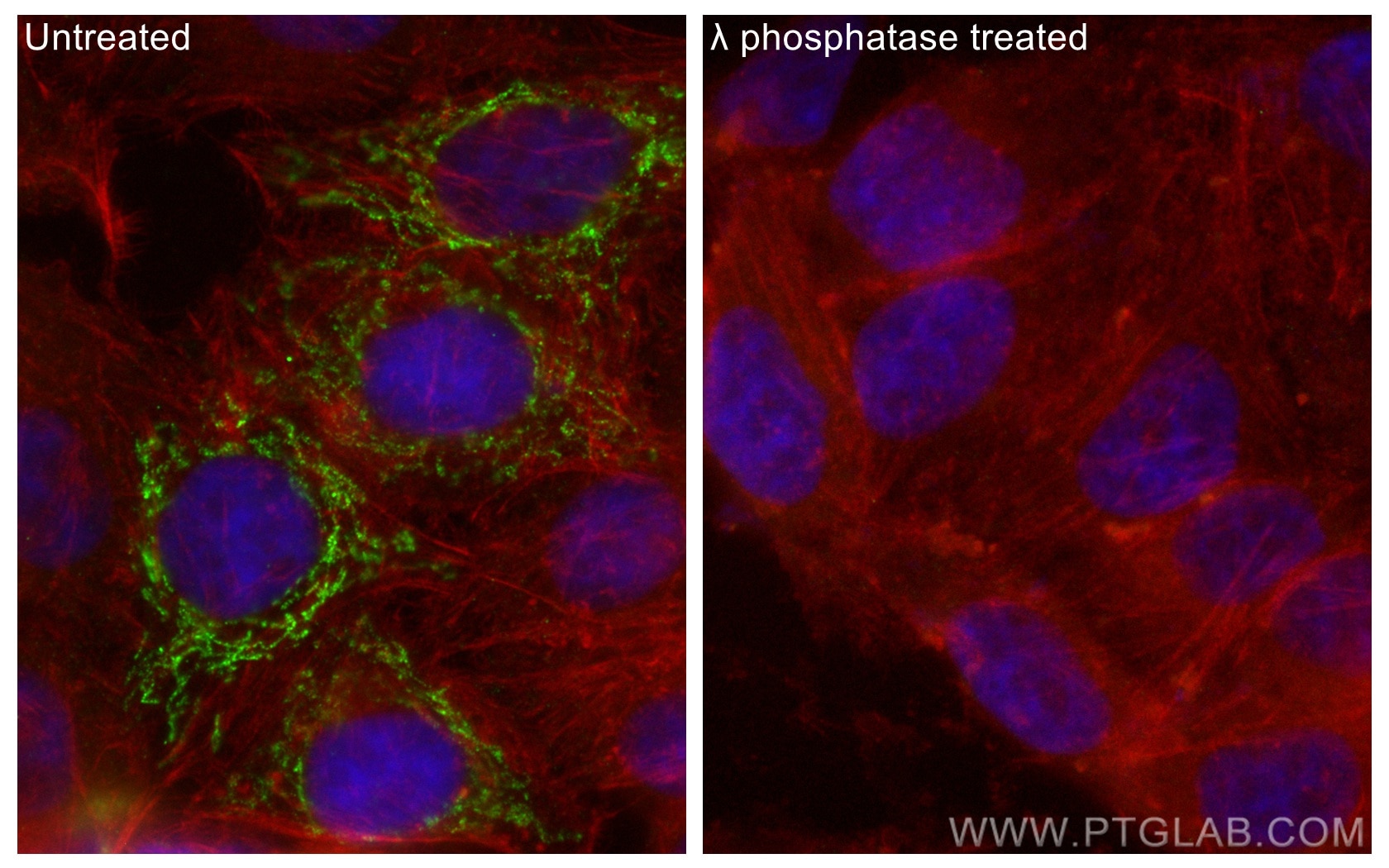 Immunofluorescence (IF) / fluorescent staining of HepG2 cells using Phospho-PDH E1 Alpha (Ser300) Recombinant antibody (80572-1-RR)
