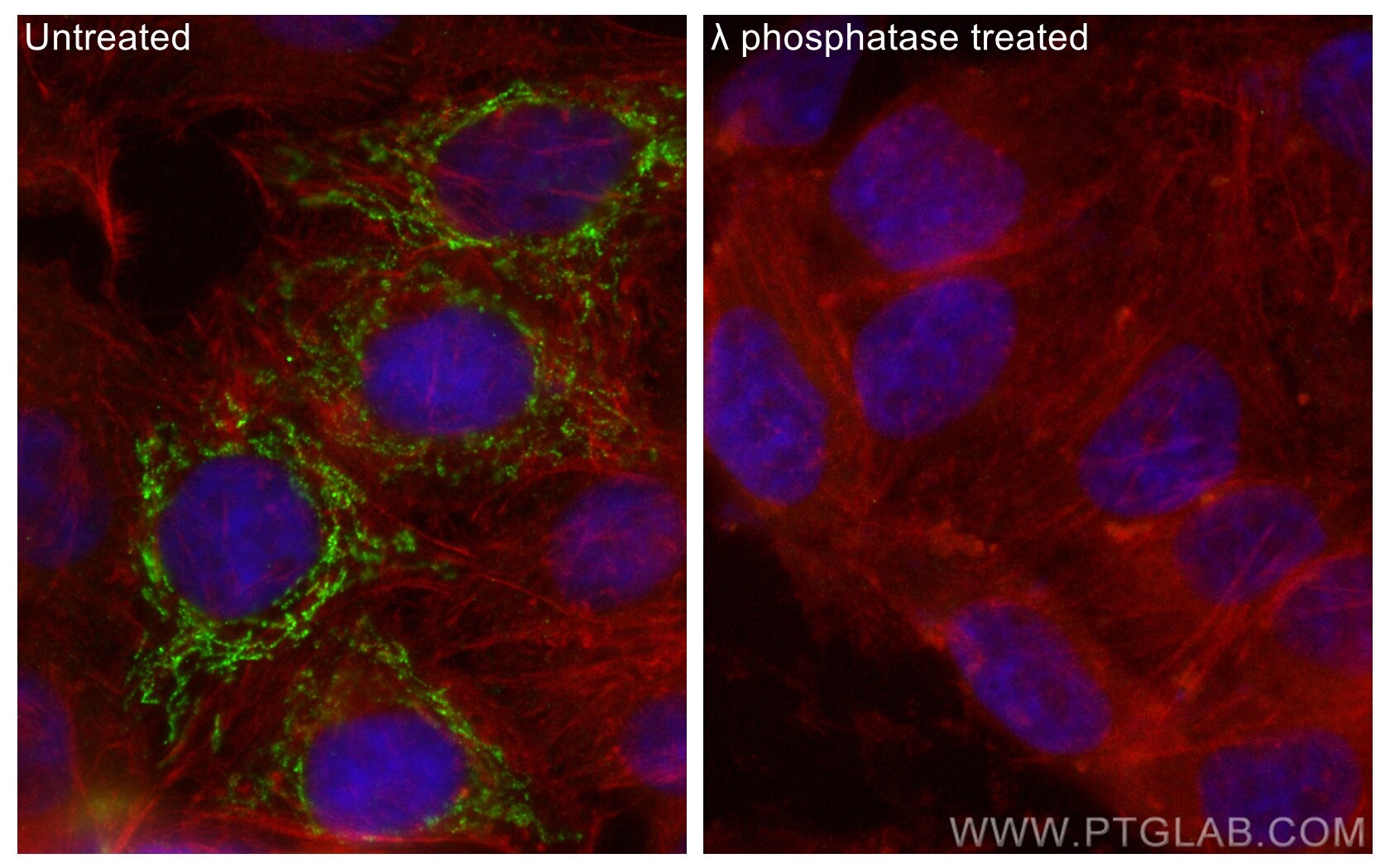 IF Staining of HepG2 using 80572-1-RR