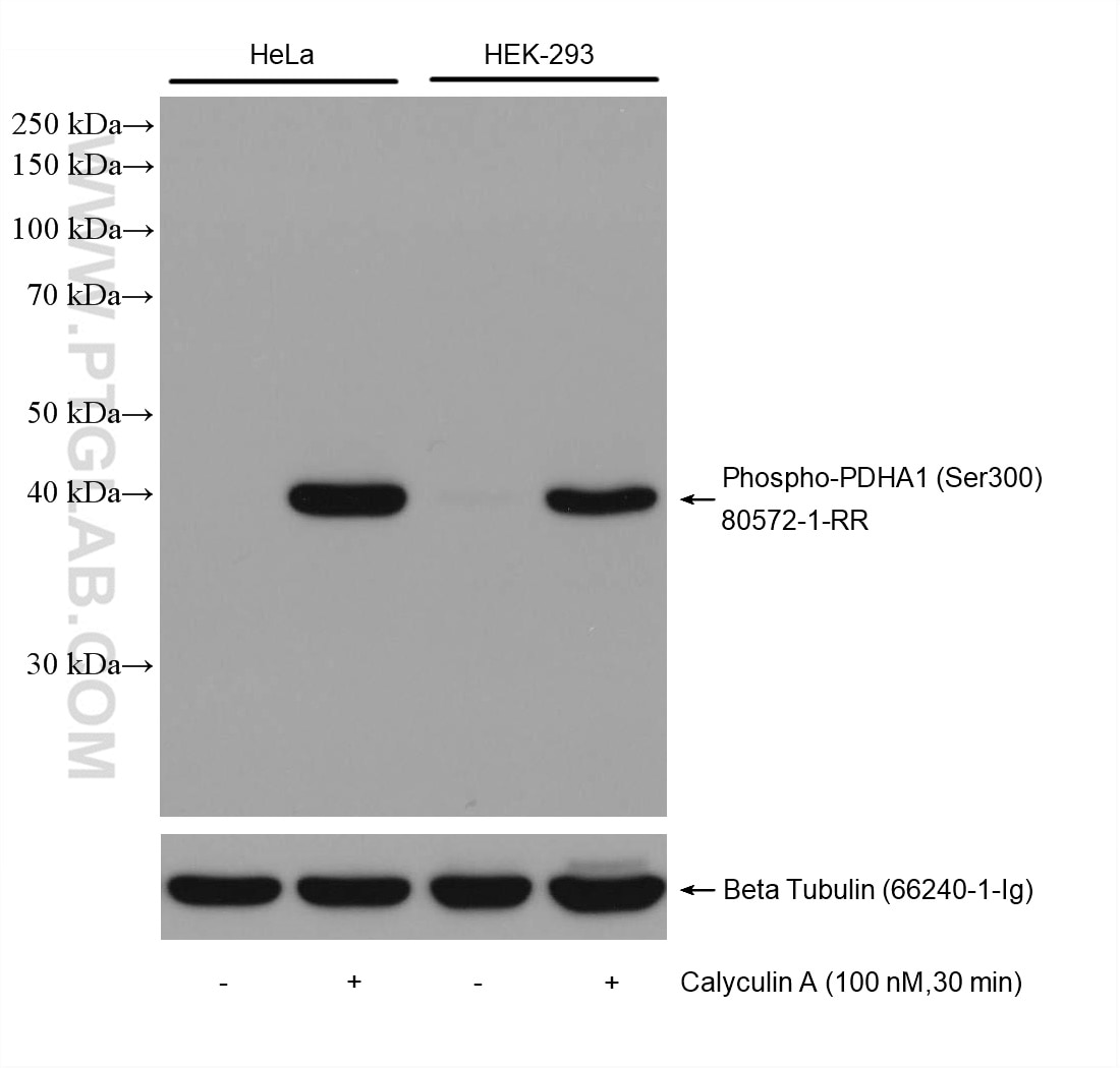 Western Blot (WB) analysis of various lysates using Phospho-PDH E1 Alpha (Ser300) Recombinant antibody (80572-1-RR)