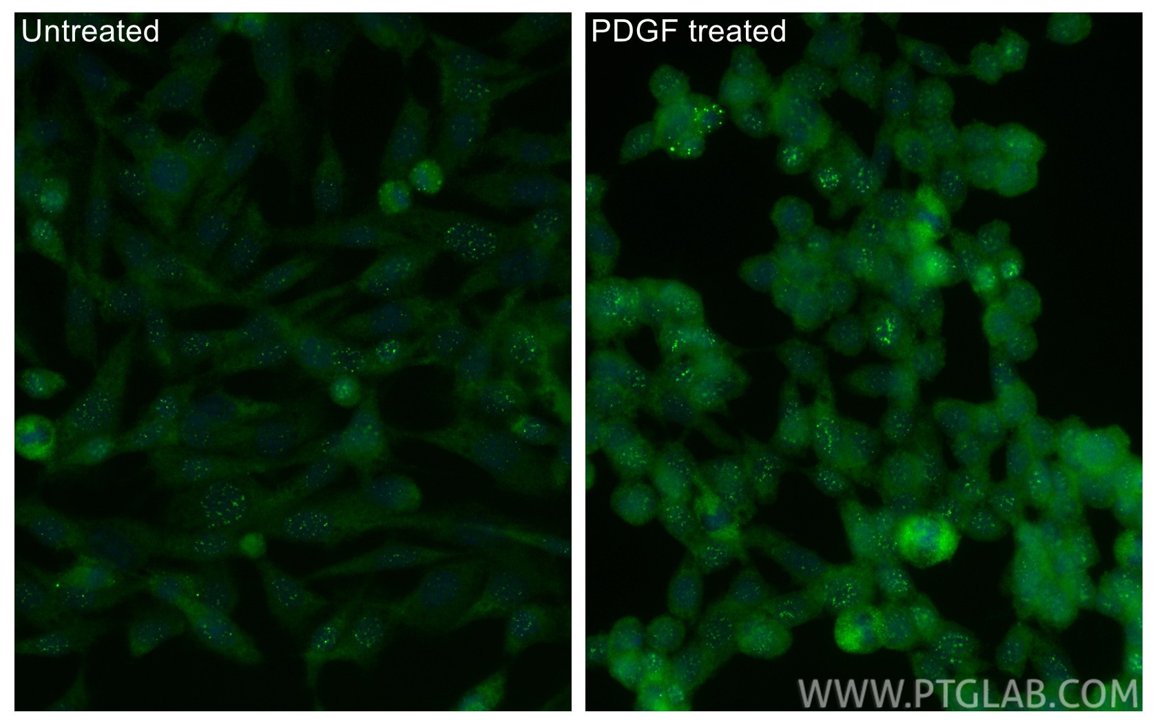 IF Staining of NIH/3T3 using 29241-1-AP Immunofluorescence (IF) / fluorescent staining of NIH/3T3 cells using Phospho-PDPK1 (Ser241) Polyclonal antibody (29241-1-AP)