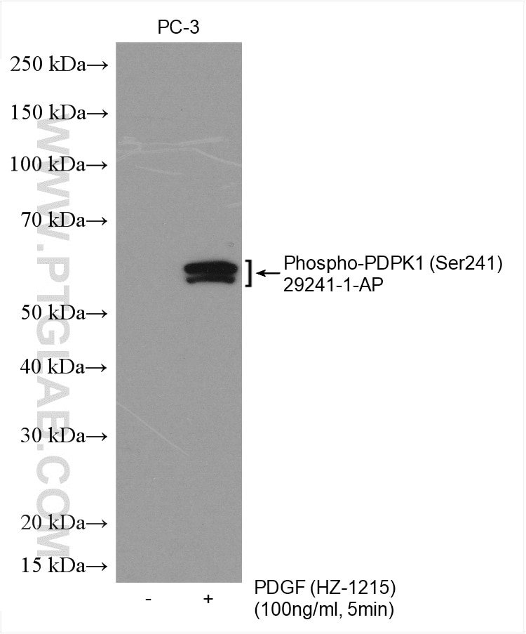 Western Blot (WB) analysis of various lysates using Phospho-PDPK1 (Ser241) Polyclonal antibody (29241-1-AP)