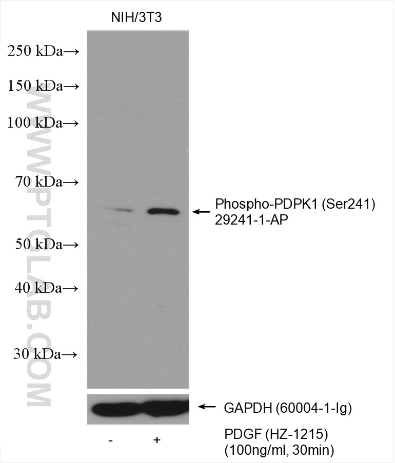 Western Blot (WB) analysis of various lysates using Phospho-PDPK1 (Ser241) Polyclonal antibody (29241-1-AP)