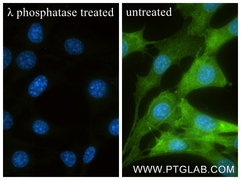 Immunofluorescence (IF) / fluorescent staining of NIH/3T3 cells using Phospho-PDPK1 (Ser241) Recombinant monoclonal anti (85223-3-RR)