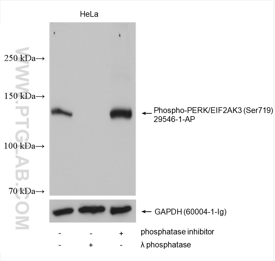 Western Blot (WB) analysis of various lysates using Phospho-PERK/EIF2AK3 (Ser719) Polyclonal antibody (29546-1-AP)