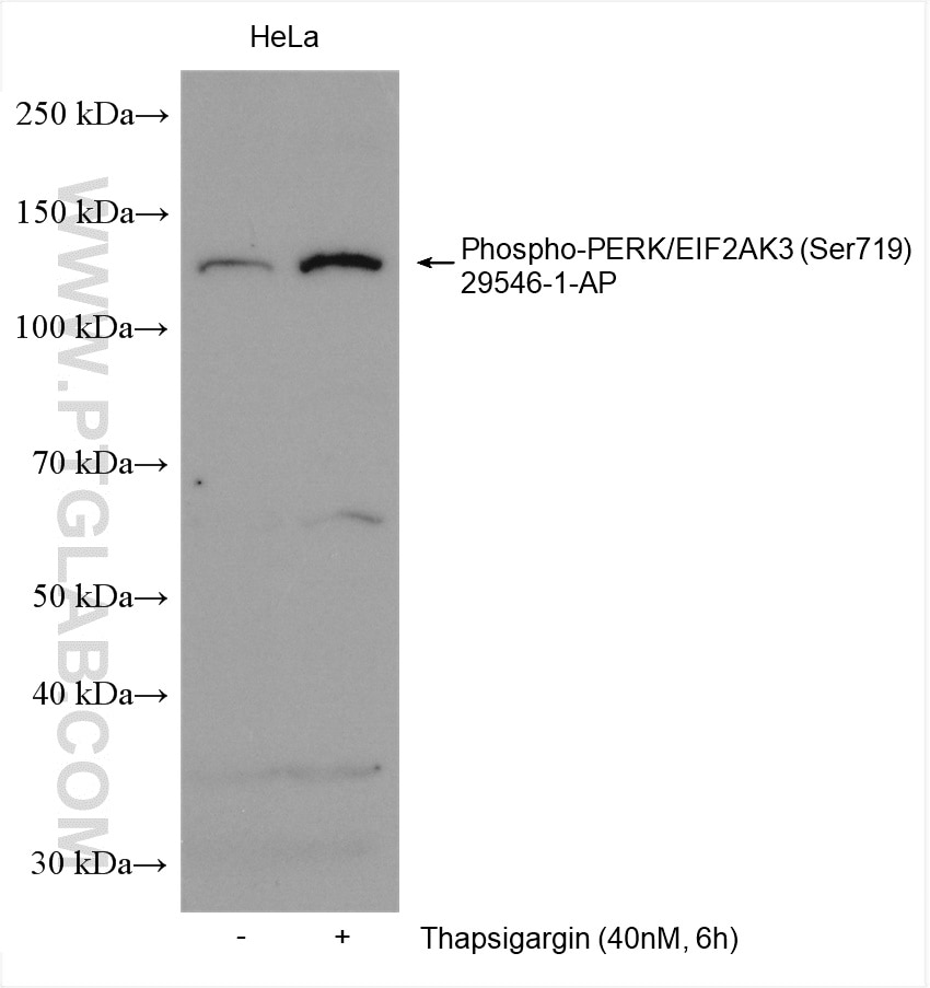 Western Blot (WB) analysis of various lysates using Phospho-PERK/EIF2AK3 (Ser719) Polyclonal antibody (29546-1-AP)