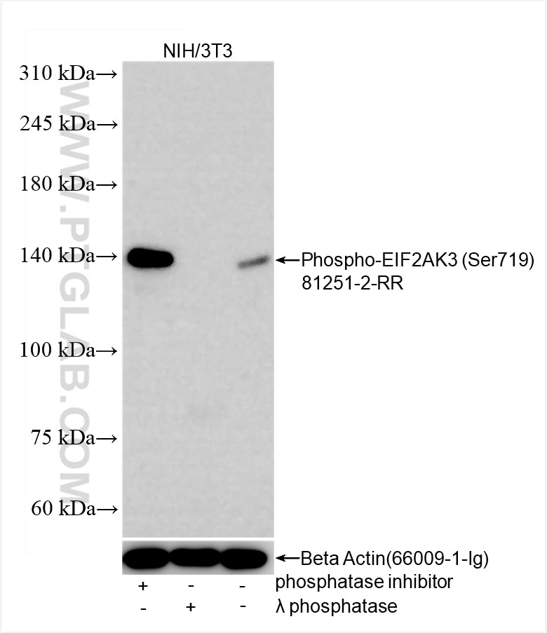 Phospho-PERK/EIF2AK3 (Ser719)