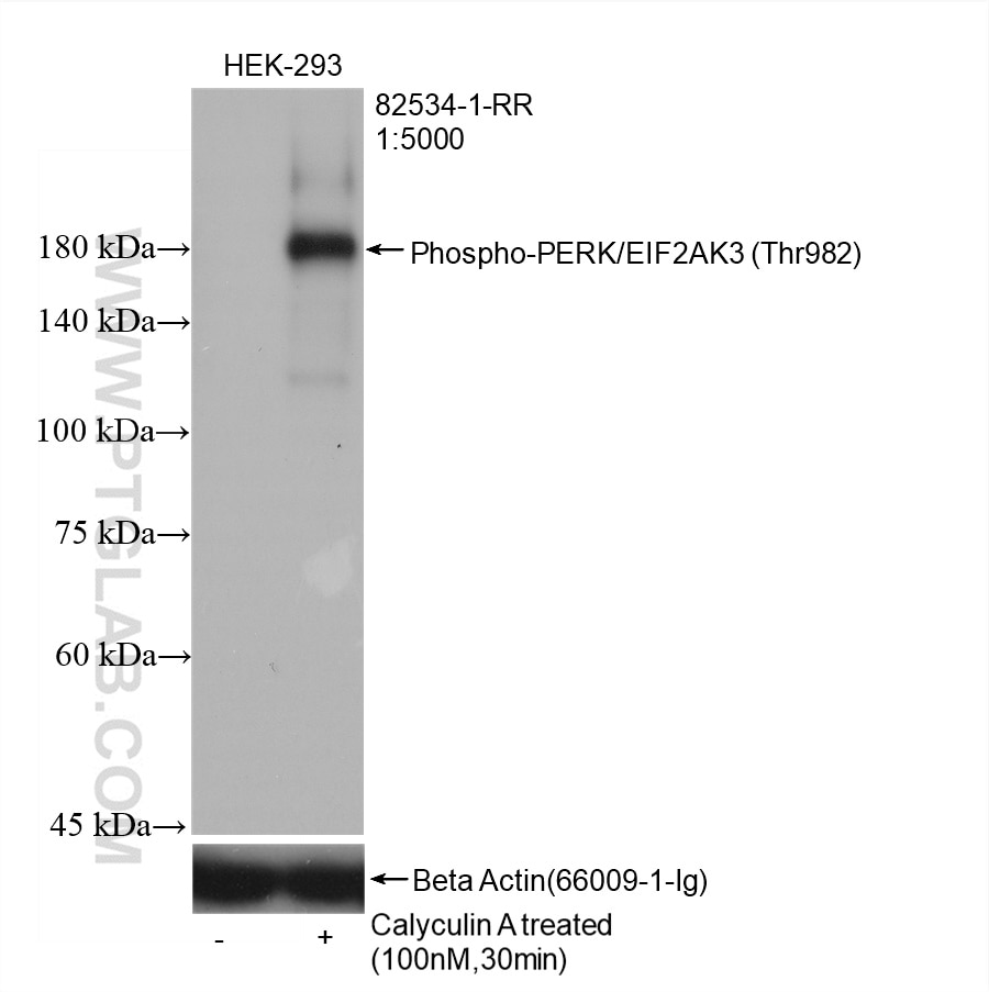 Western Blot (WB) analysis of HEK-293 cells using Phospho-PERK/EIF2AK3 (Thr982) Recombinant antibody (82534-1-RR)