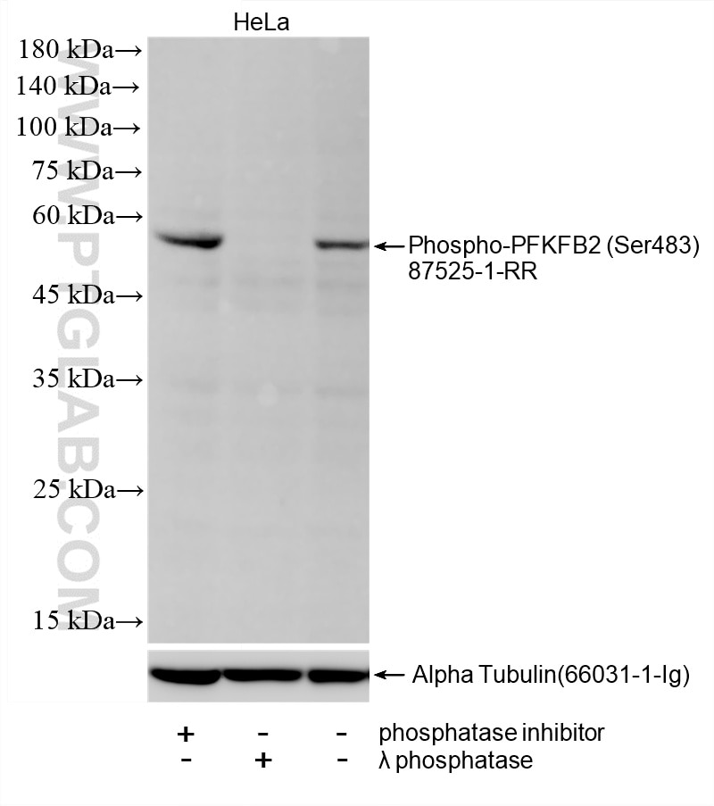 Non-treated HeLa cells, phosphatase inhibitor treated HeLa cells and λ phosphatase treated HeLa cells were subjected to SDS PAGE followed by western blot with 87525-1-RR (Phospho-PFKFB2 (Ser483) antibody) at dilution of 1:2000 incubated at room temperature for 1.5 hours. The membrane was stripped and re-blotted with Alpha Tubulin (66031-1-Ig) antibody as a loading control. This data was developed using the same antibody clone with 87525-1-PBS in a different storage buffer formulation. Western Blot (WB) analysis of HeLa cells using Phospho-PFKFB2 (Ser483) Recombinant monoclonal ant (87525-1-RR)