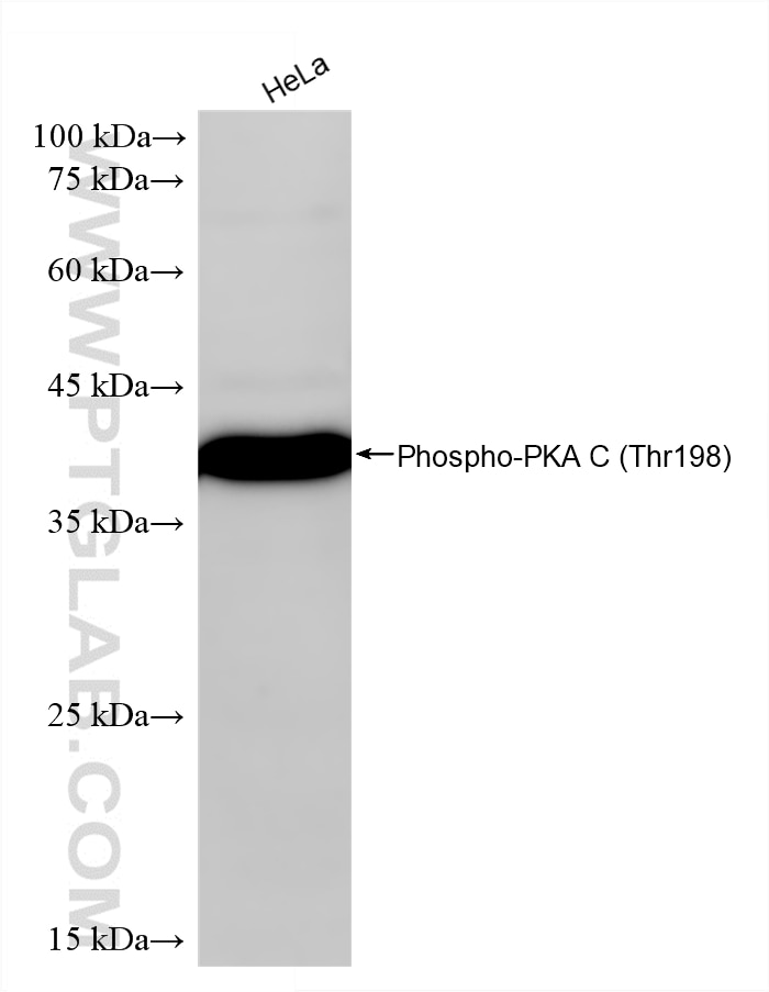 Western Blot (WB) analysis of HeLa cells using Phospho-PKA C (Thr198) Recombinant monoclonal anti (87365-3-RR)