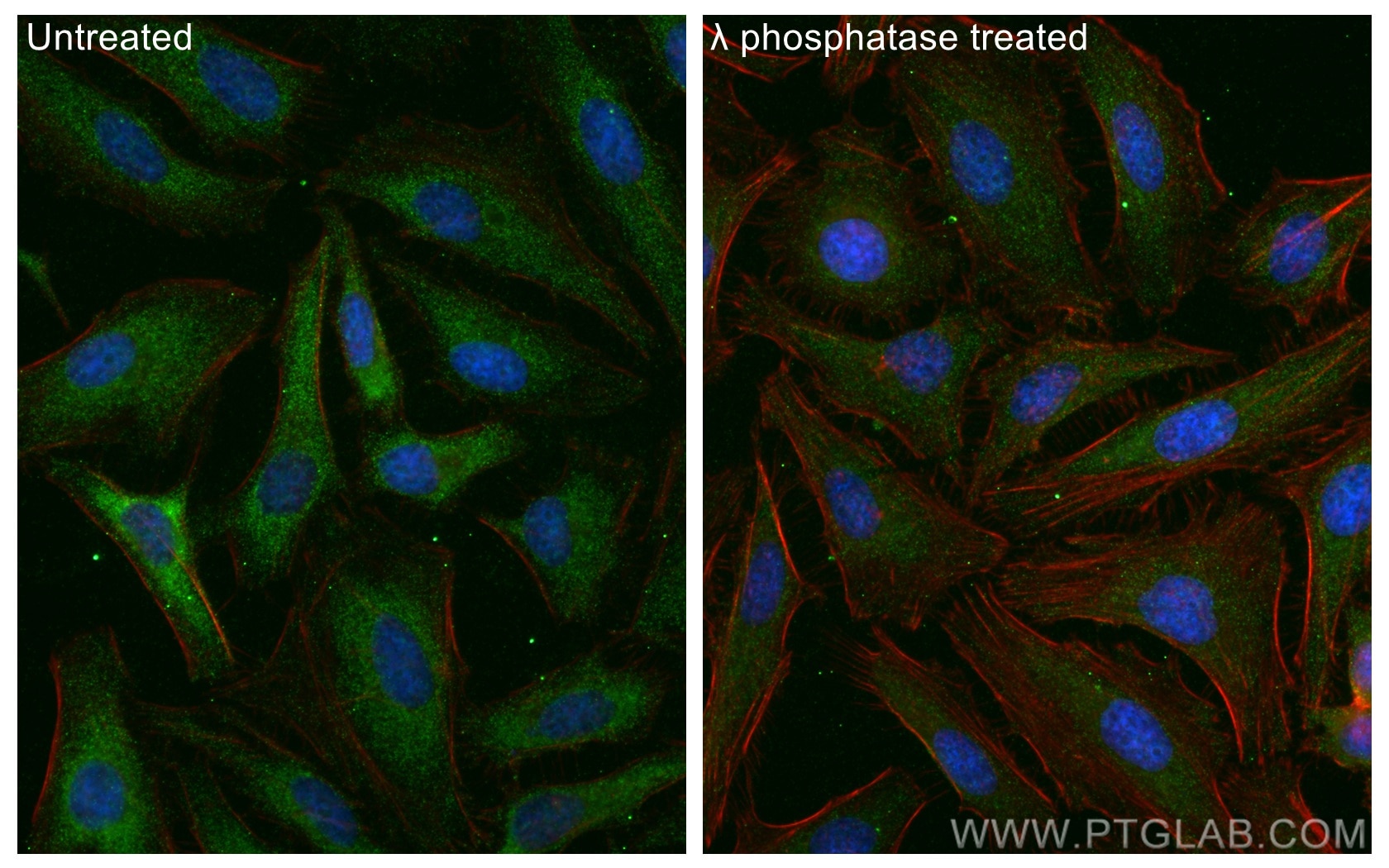 Immunofluorescence (IF) / fluorescent staining of HeLa cells using Phospho-PKC Alpha (Ser657) Polyclonal antibody (28926-1-AP)