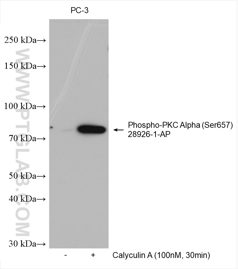 Western Blot (WB) analysis of various lysates using Phospho-PKC Alpha (Ser657) Polyclonal antibody (28926-1-AP)