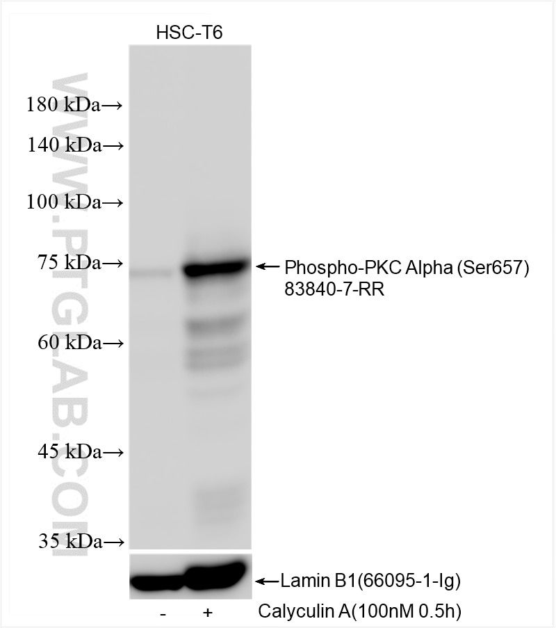 Western Blot (WB) analysis of various lysates using Phospho-PKC Alpha (Ser657) Recombinant antibody (83840-7-RR)