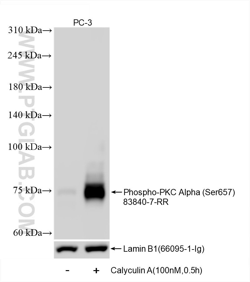 Western Blot (WB) analysis of various lysates using Phospho-PKC Alpha (Ser657) Recombinant antibody (83840-7-RR)